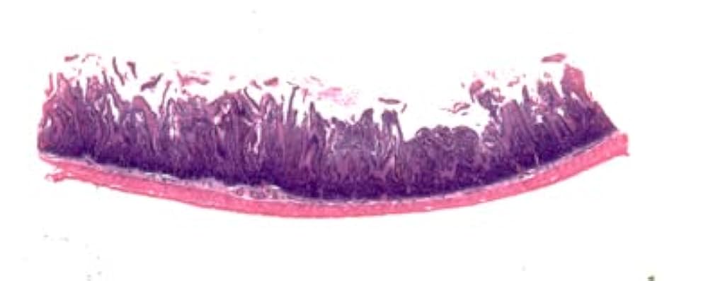 31R+xGasINL._UF1000,1000_QL80_.jpg